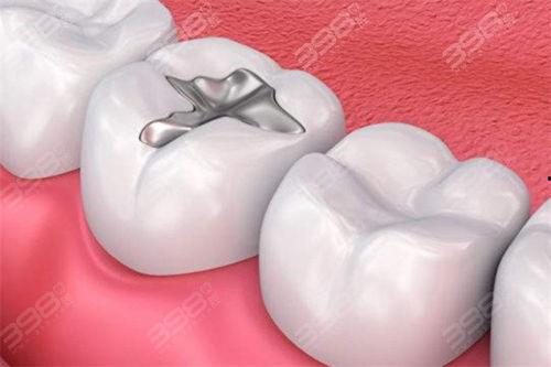 成人补牙体验视频,真实体验视频解析-第2张图片-成人抖抈app